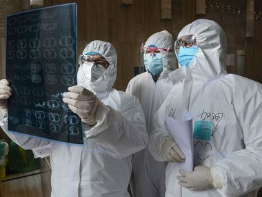 Doctors look at a lung CT image at a hospital in Xiaogan,China.